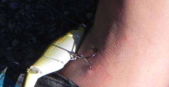 If you're an angler or a boater, chances are you'll have a close encounter with a fish hook sooner or later.
